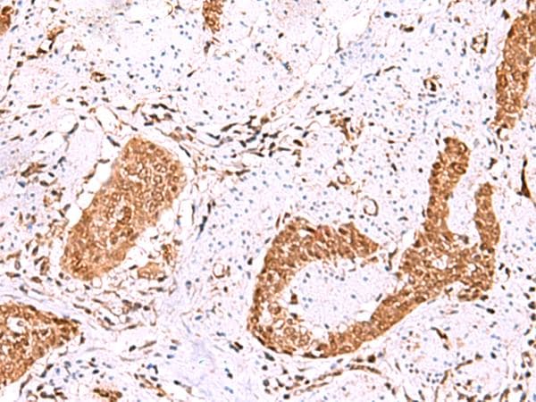 FDPS Antibody