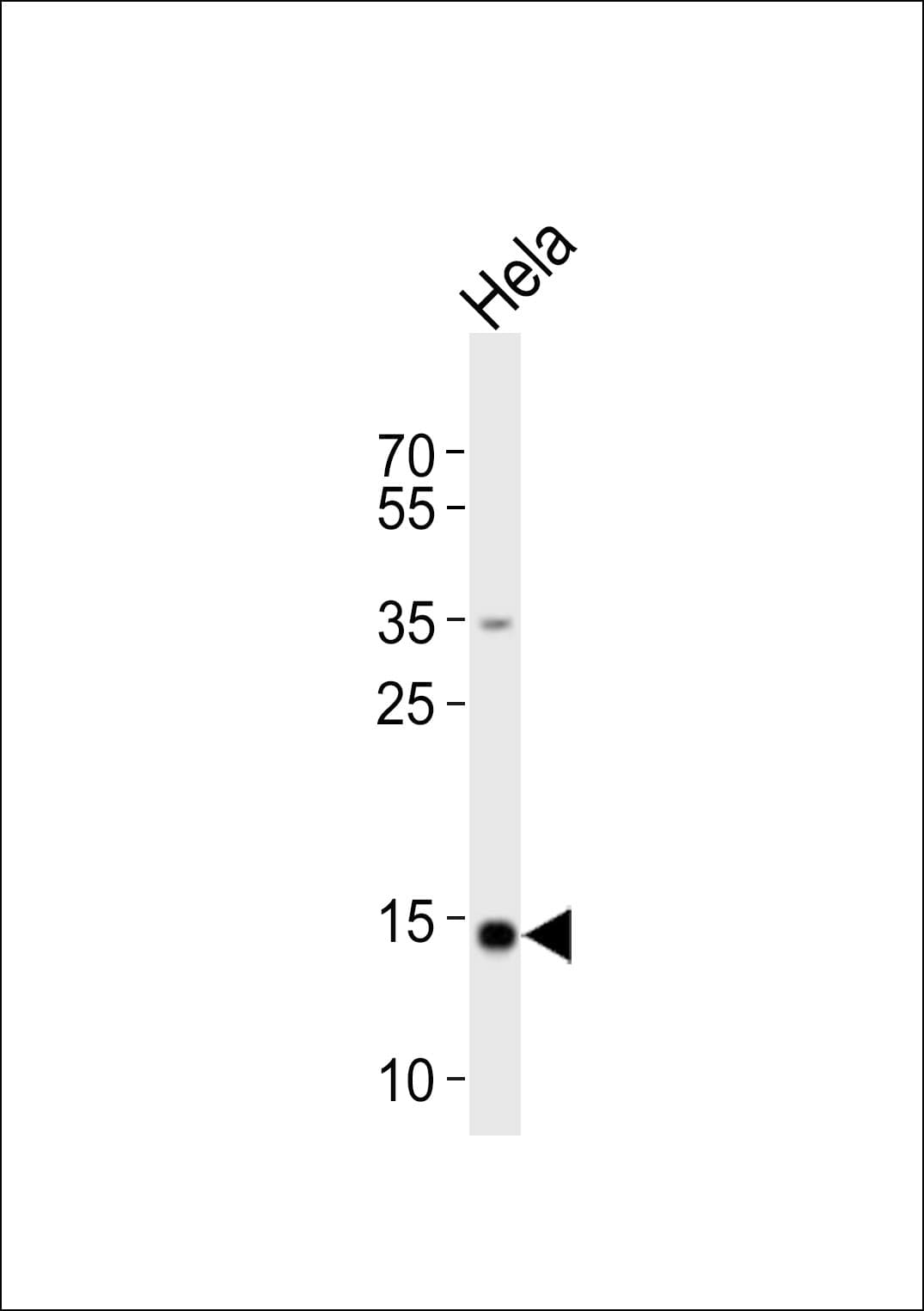 FIS1 Antibody (aa6-40)