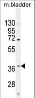 C12orf29 Antibody (aa61-89)