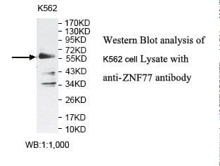 Polyclonal Rabbit anti-Human ZNF77 Antibody (aa5-258, IHC, WB)