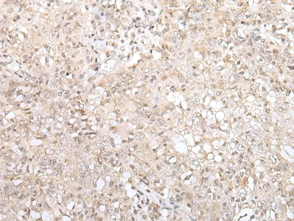 ZNF263 Antibody