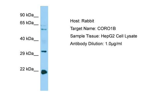CORO1B Antibody (C-Terminus)