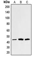 Polyclonal Rabbit anti-Human SGCA / DAG2 Antibody (Internal, WB)