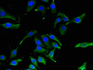 CBR / CBR1 Antibody