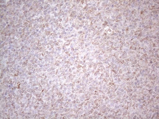 PODXL / Podocalyxin Antibody (aa32-461, clone OTI2C6)