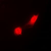 PSMC2 / RPT1 Antibody