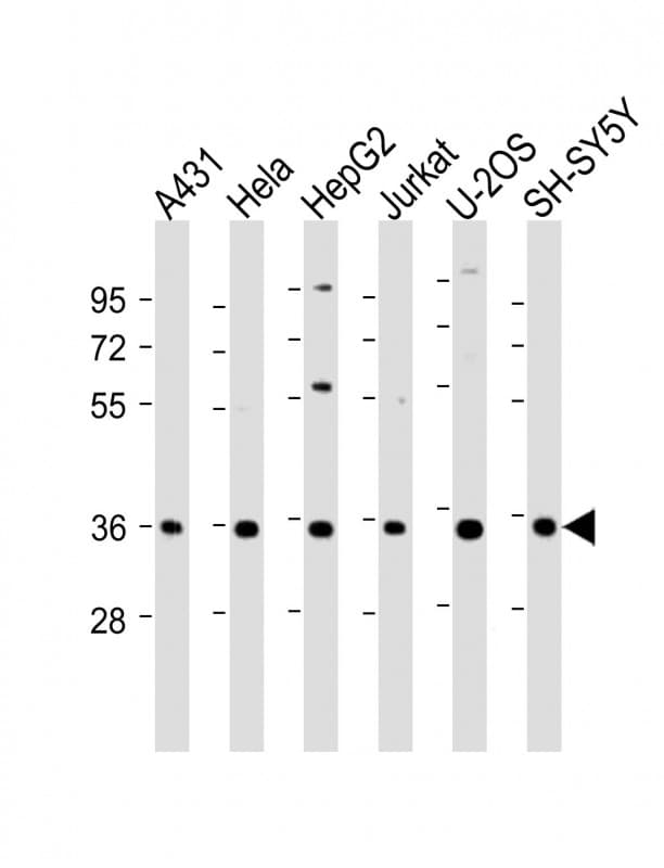 NT5C3A Antibody (aa282-313)