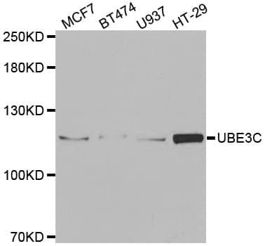 Polyclonal Rabbit anti-Human UBE3C Antibody (IHC, IF, WB)