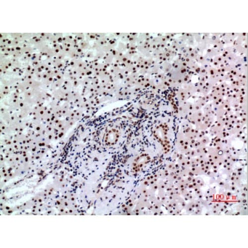Polyclonal Rabbit anti-Human BCL6 Antibody (271-320 aa, Internal, IHC, WB)
