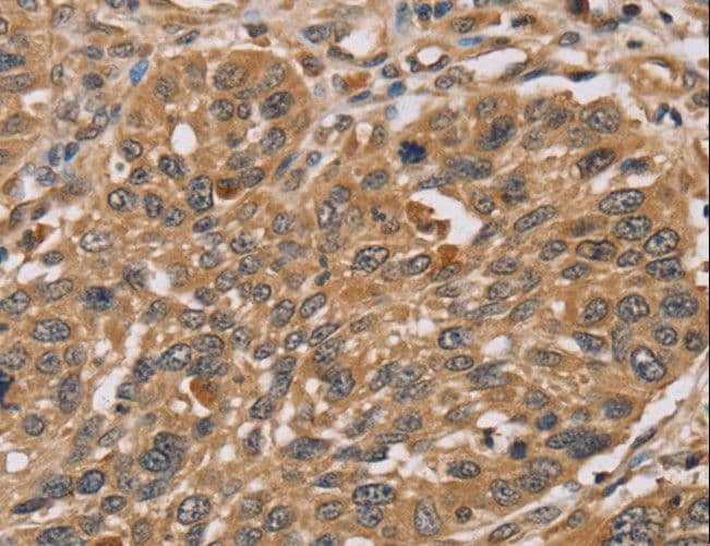 Polyclonal Rabbit anti-Human RMA1 / RNF5 Antibody (IHC, WB)
