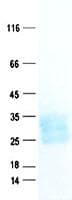 Human CD3E Protein (Recombinant His,C-terminus)