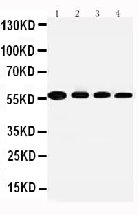 Polyclonal Rabbit anti-Human ALDH2 Antibody (aa18-33, IHC, WB)