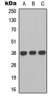Polyclonal Rabbit anti-Human P2Y13 / P2RY13 Antibody (Internal, IF, WB)