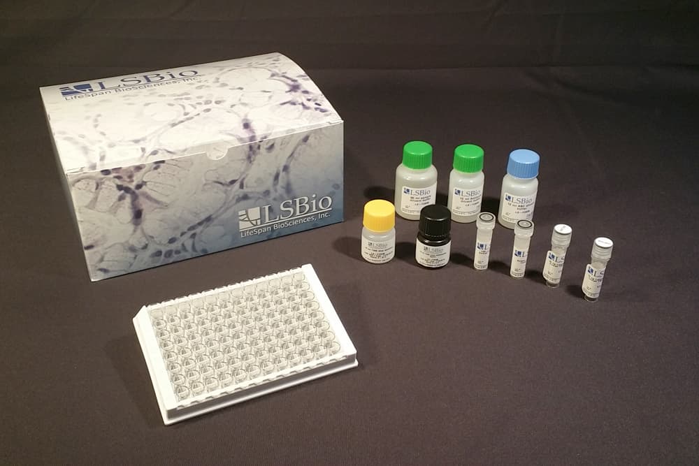 Human OMD / Osteomodulin ELISA Kit (Sandwich ELISA)