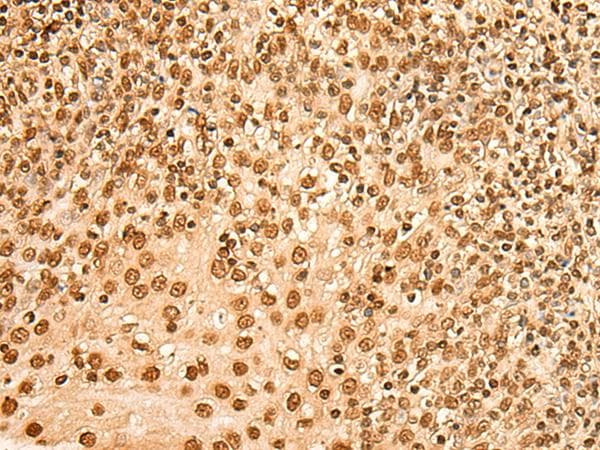 Polyclonal Rabbit anti-Human HIST1H2BA Antibody (IHC, WB)