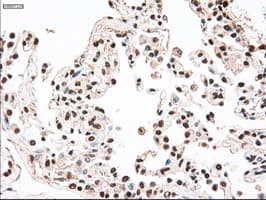 MAP2K4 / MKK4 Antibody (clone OTI4B4)