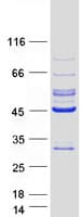 Human LRPB7 / LRRC23 Protein (Recombinant Myc-DDK (Flag))