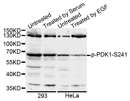 PDPK1 / PDK1 Antibody (phospho-Ser241)
