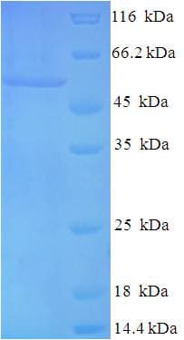 Chlamydia trachomatis ompA Protein (Recombinant His-SUMO)