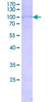 Human TXK / RLK Protein (Recombinant GST, N-terminus)