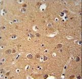Polyclonal Rabbit anti-Human ZDHHC2 Antibody (aa77-106, IHC, WB)