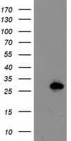Latexin / MUM Antibody (clone OTI2G4, Carrier-free)