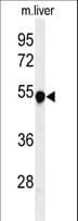 PH / PAH Antibody (aa132-161)