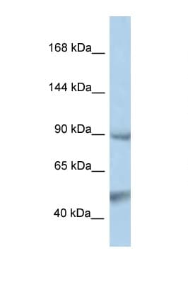 PTPN3 Antibody (aa106-155)