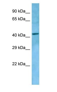 Polyclonal Rabbit anti-Human LPAR5 / GPR92 Antibody (aa302-351, WB)