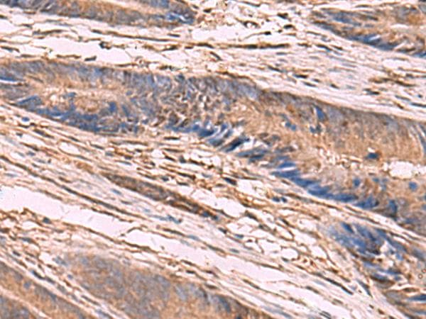 KCNN2 Antibody
