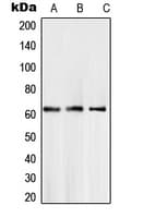 Polyclonal Rabbit anti-Human SMAD6 Antibody (Internal, IHC, WB)