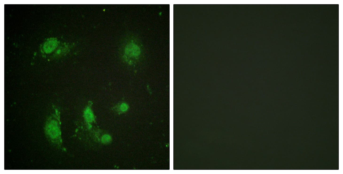 PathPlus™ Polyclonal Rabbit anti-Human BIRC5 / Survivin Antibody (aa86-135, IHC, IF, WB)