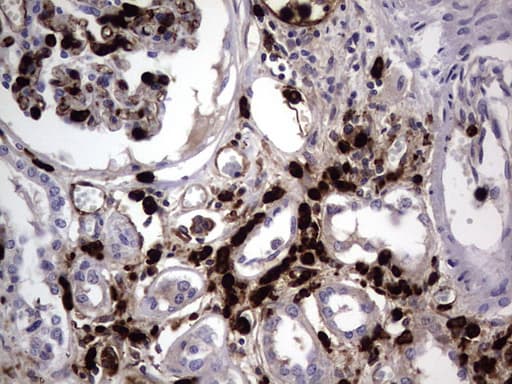 Monoclonal Mouse anti-Human CEACAM5 / CD66e Antibody (clone OTI3D8, aa35-680, IHC, WB)