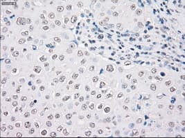 Monoclonal Mouse anti-Human STK3 Antibody (clone OTI2D4, IHC, WB)