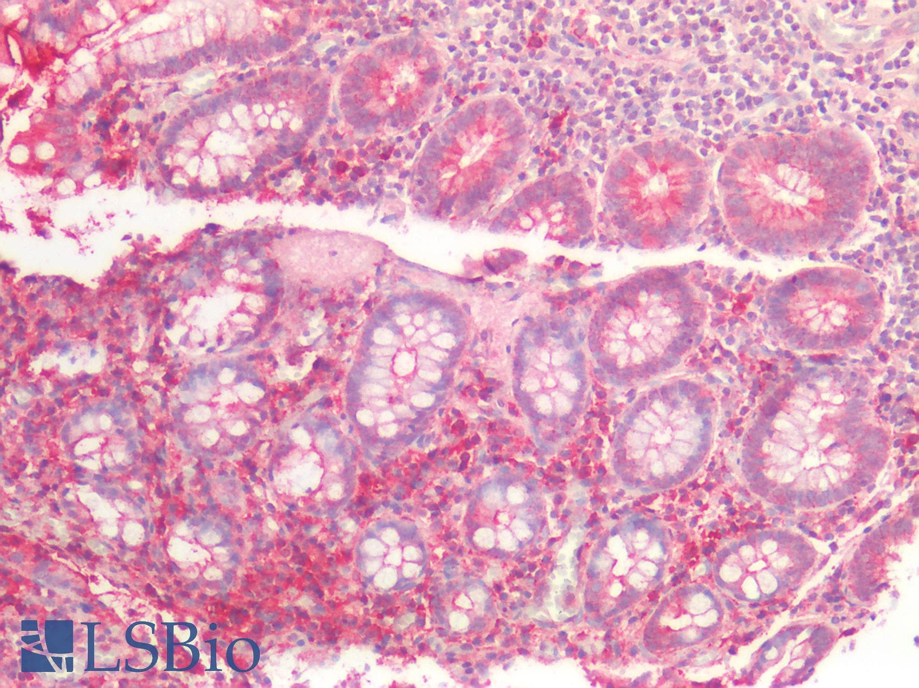 PathPlus™ MLPH / Melanophilin Antibody