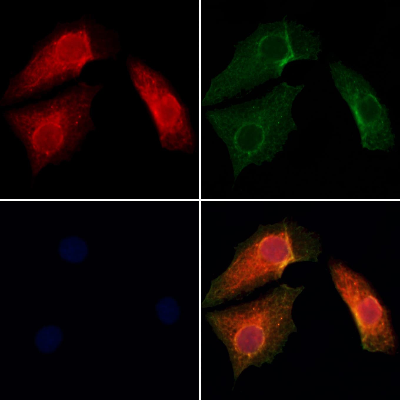 SH3BP5 / SAB Antibody
