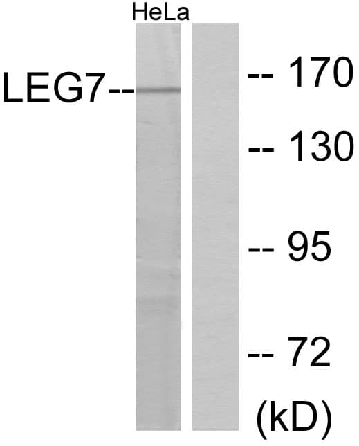 LGALS7 / Galectin 7 Antibody (aa41-90)