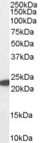 IHC-plus™ GPX1 / Glutathione Peroxidase Antibody (aa130-142)
