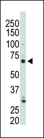 PIP5K1C Antibody (aa26-57)