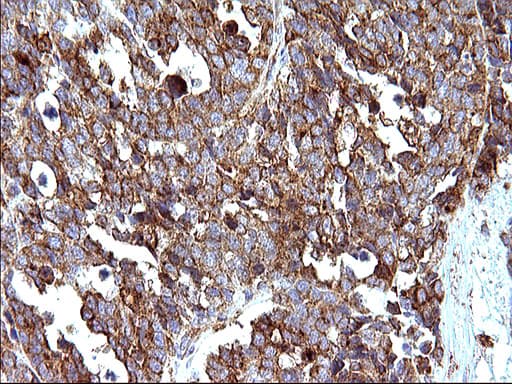 Monoclonal Mouse anti-Human SCAMP2 Antibody (clone OTI1H10, IHC, WB)