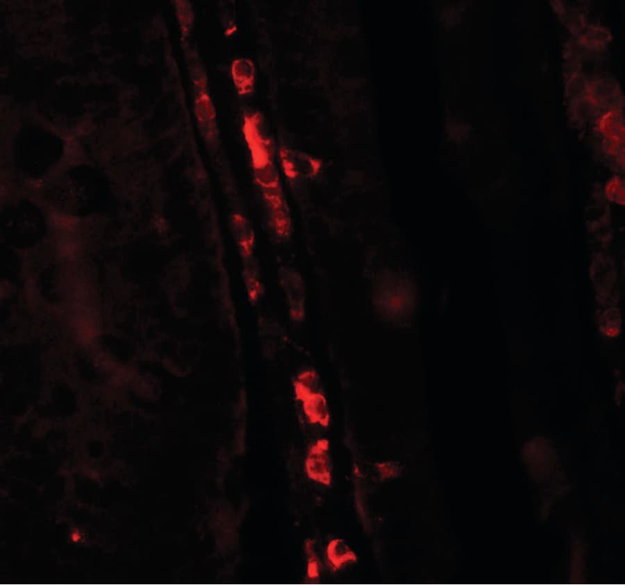 IHC-plus™ ERAP2 / Aminopeptidase Antibody