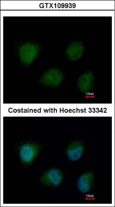 OGT / O-GLCNAC Antibody (aa223-502)