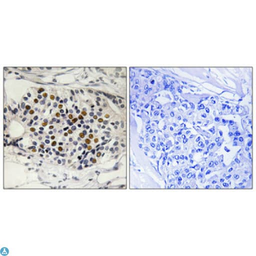 p16INK4a / CDKN2A Antibody