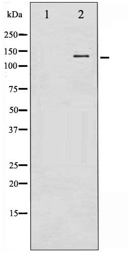 NOS1 / nNOS Antibody (phospho-Ser852)