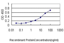 IHC-plus™ FGG / Fibrinogen Gamma Antibody (clone 1F2)