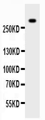 VWF / Von Willebrand Factor Antibody (aa2535-2813)
