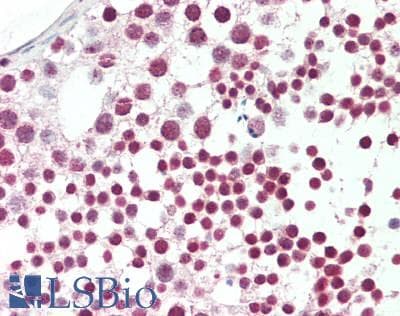 IHC-plus™ RBM23 Antibody