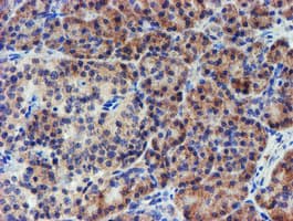LECT2 Antibody (aa19-151, clone OTI2A11, Carrier-free)