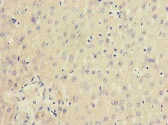 Polyclonal Rabbit anti-Human IL20RA Antibody (IHC)