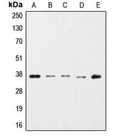 Polyclonal Rabbit anti-Human GAPDH Antibody (N-Terminus, WB)